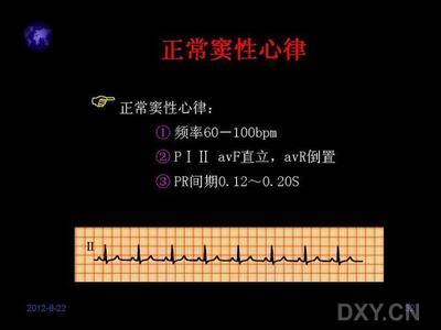 窦性心律正常吗? 窦性心律严重吗