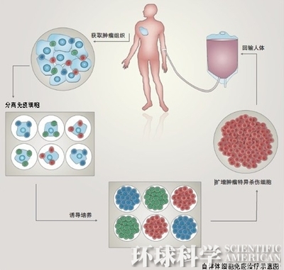 肿瘤转移的研究现状与治疗前景展望5 公司前景展望