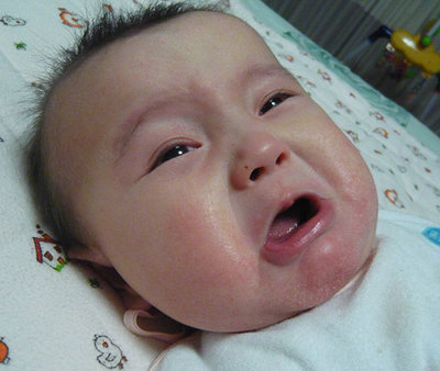 婴儿湿疹治疗方法大全 婴儿湿疹多久能自愈