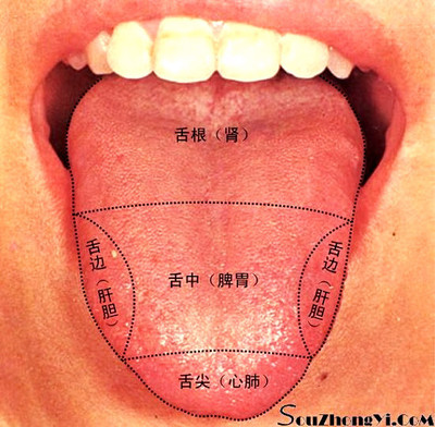 舌头有裂纹 舌头开裂是怎么回事