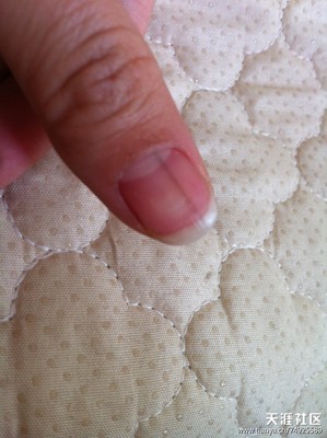 我的大拇指指甲上有一条黑线 大拇指指甲黑线