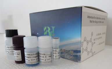 免疫球蛋白 免疫球蛋白试剂盒