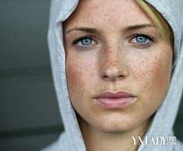 女人脸上长斑的原因 脸上长斑吃什么调理
