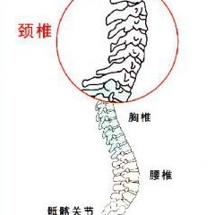 颈椎病有什么表现？颈椎病的类型？ 颈椎病临床表现