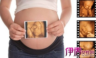 胎儿发育全过程四维彩超图片(组图) 24周胎儿四维彩超