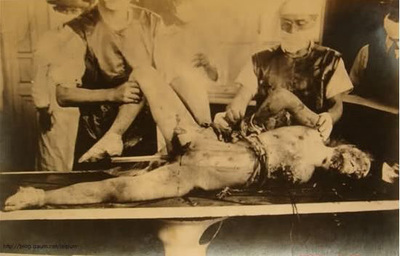 史上最残忍恐怖的731活体解剖女人实验（组图） 解剖活体美女漫画