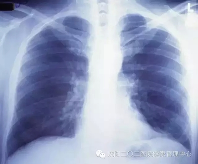 拍X光片、CT和磁共振（MRI）检查有什么区别？如何选择？ x光片和ct的区别