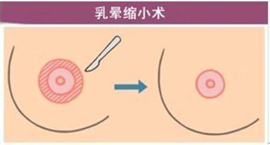  经验温标的缺点 经验往往被拨高，缺点总是被缩小