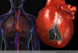  心脏病吃什么药 致死 塑料制品或致心脏病