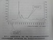  邦克楼 纳尔逊·邦克·亨特