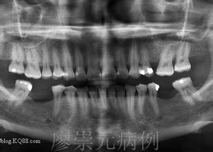  风险投资 风险篇