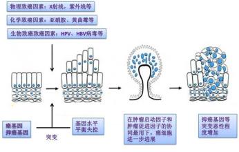  跨国公司企业文化/管理“基因变异”病从何来？