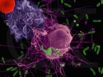 癌症为什么难治愈：日本完成iPS细胞治癌实验