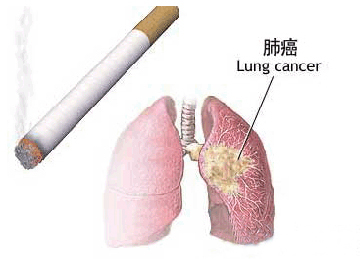 抽烟会导致肺癌是否属实