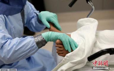 感染埃博拉病毒有救吗：美国医护工作新规范再有一人治愈