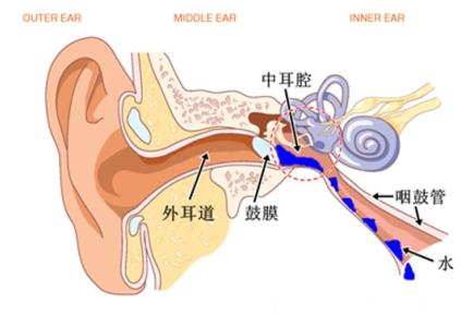 分泌性中耳炎 分泌性中耳炎-简要介绍，分泌性中耳炎-疾病病因