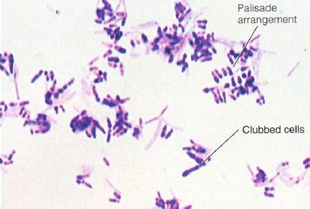 棒状杆菌属 棒状杆菌属-致病物质，棒状杆菌属-分类