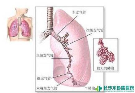 间质性肺炎 间质性肺炎-疾病描述，间质性肺炎-疾病病因