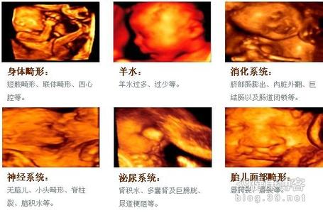 看看怀孕六个月的图片 六个月胎儿四维彩超清晰吗