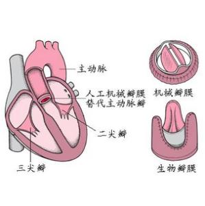 慢性肺源性心脏病 慢性肺源性心脏病-临床表现，慢性肺源性心脏病
