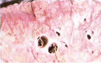 羊肺线虫病 羊肺线虫病-概述，羊肺线虫病-临床症状
