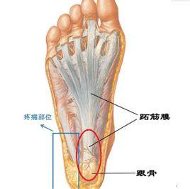 跟骨骨膜炎 跟骨骨膜炎-病因，跟骨骨膜炎-病理