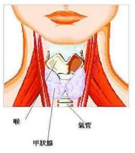 甲状腺亢进 甲状腺机能亢进 甲状腺机能亢进-简要介绍，甲状腺机能亢进-基本