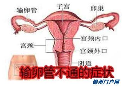 输卵管堵塞 输卵管堵塞-疾病概述，输卵管堵塞-疾病病因