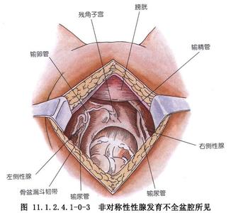 睾丸全切除术手术图片 阴蒂切除术 阴蒂切除术-简介，阴蒂切除术-手术方法
