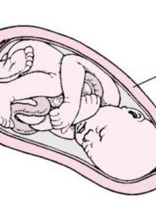 子宫收缩乏力 子宫收缩乏力 子宫收缩乏力-概述，子宫收缩乏力-病因
