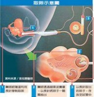 捐卵 捐卵-中国现状，捐卵-基本常识
