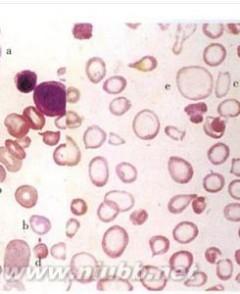 血红细胞介绍 红细胞 红细胞-基本介绍，红细胞-种类介绍