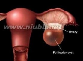 卵巢畸胎瘤 卵巢畸胎瘤-概述，卵巢畸胎瘤-分类