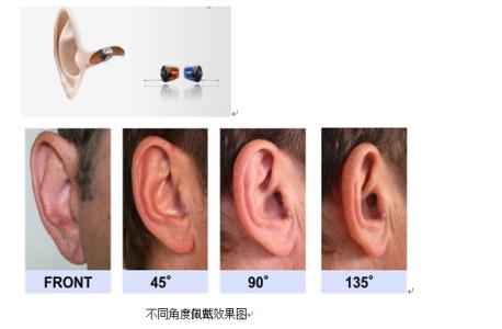 隐形助听器 隐形助听器 隐形助听器-历史，隐形助听器-优点