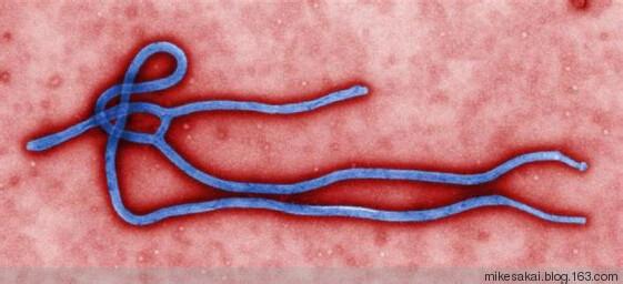 艾博拉病毒电影 艾博拉病毒