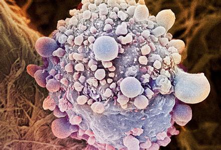 癌细胞的主要特征 癌细胞 癌细胞-主要特征，癌细胞-主要种类