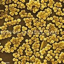 金色葡萄球菌球菌 金黄色葡萄球菌 金黄色葡萄球菌-简介，金黄色葡萄球菌-流行病学