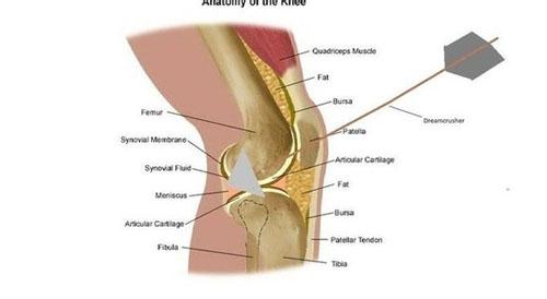膝盖中了一箭 出处 膝盖中箭体 膝盖中箭体-出处，膝盖中箭体-用法