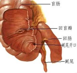 妊娠合并阑尾炎 妊娠合并阑尾炎 妊娠合并阑尾炎-概述，妊娠合并阑尾炎-位置的改