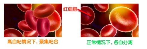 血液粘稠 血粘 血粘-血液粘稠原因，血粘-增加血液粘稠的因素