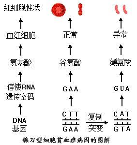 镰刀形红细胞贫血症 镰刀型细胞贫血症 镰刀型细胞贫血症-疾病描述，镰刀型细胞贫血症