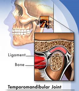 颞颌关节炎发病率 颞颌关节炎 颞颌关节炎-临床症状，颞颌关节炎-发病原因