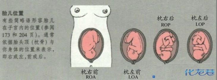 疾病术语 ROP ROP-疾病，ROP-术语