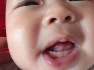 宝宝长牙的症状 宝宝长牙时期的症状