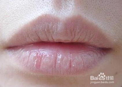 嘴唇干裂是怎么回事 嘴唇干裂怎么回事？如何保养唇部？