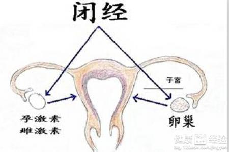 多囊卵巢闭经怎么办 卵巢性闭经 卵巢性闭经-概述，卵巢性闭经-原因