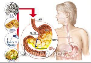 急性前列腺炎病因病理 急性胃扩张 急性胃扩张-概述，急性胃扩张-病因病理
