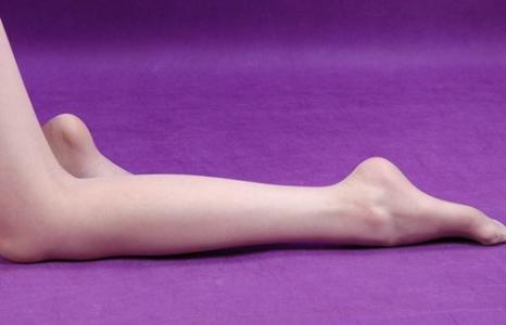 小腿水肿是什么原因 水肿腿 水肿腿-症状，水肿腿-原因