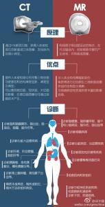 尿动力学检查 术语 CT检查 CT检查-简介，CT检查-相关术语