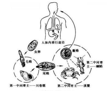 肾小球疾病概述 肺吸虫 肺吸虫-疾病概述，肺吸虫-疾病描述